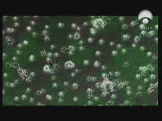 Neurogenesis: Fred Gage