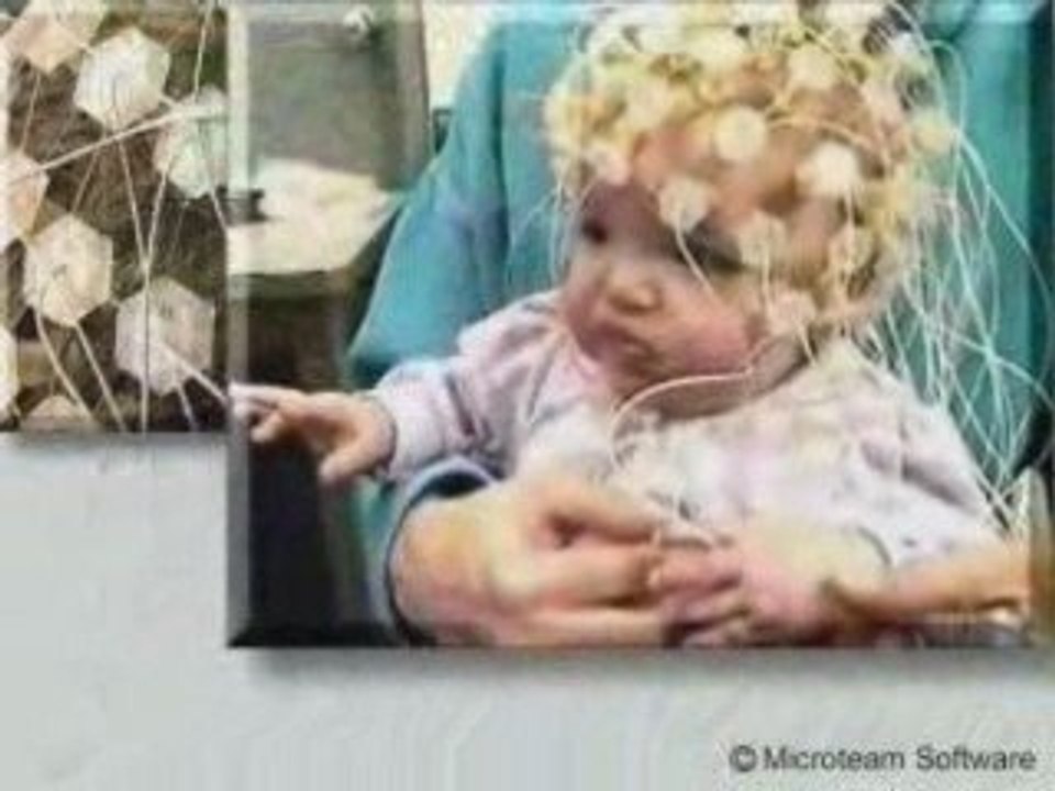 préfrontal (Impressionant miracle de coran )