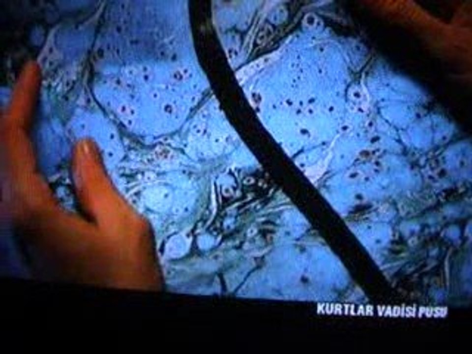 Polatın zor kararı..(bir fırtına tuttu bizi)