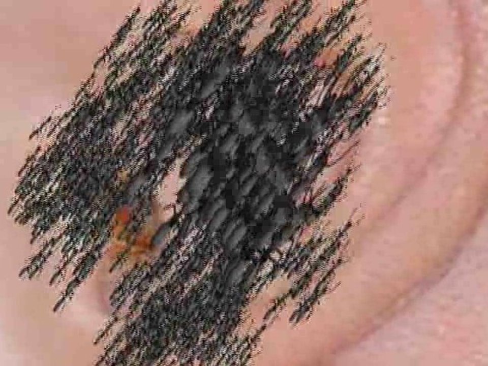 Zac Efron's Disgusting, Filthy Ears