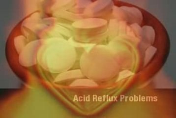 How to Cure Heartburn