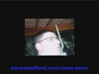 Acne Free in 3 Days is Giving Me a Zit Free Life