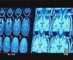 Cerebro enamorado: Quimica del amor