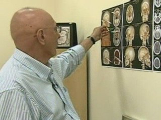 Man survives spear in the head