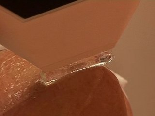 Suppression des taches à l'aide de la lumière pulsée