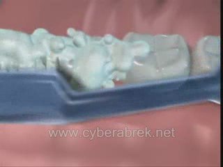 Elif Dis Sagligi  - Turkce Cizgi Film ( www.cyberabrek.net