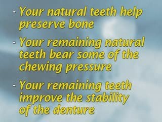 Dental Patient Education - Dentures