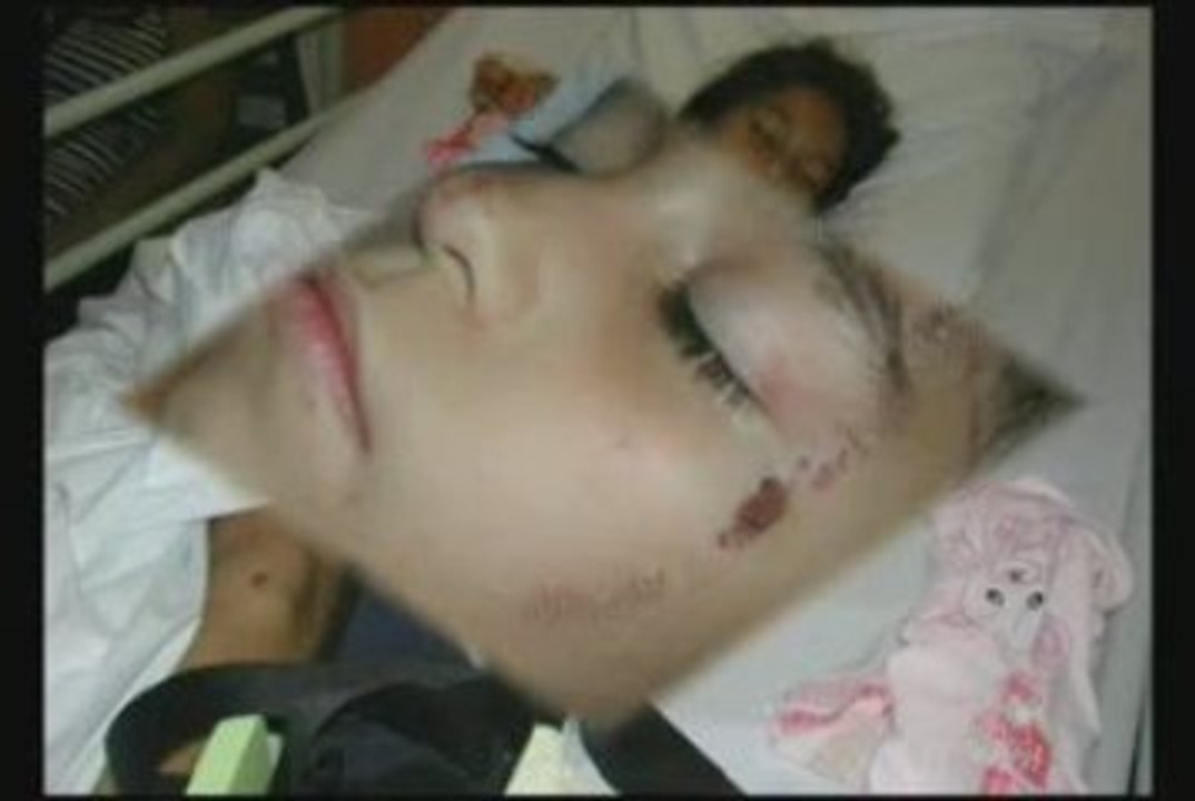 Testimonio de una niña salvada de 1 acidente