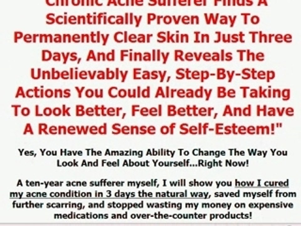 Acne Books