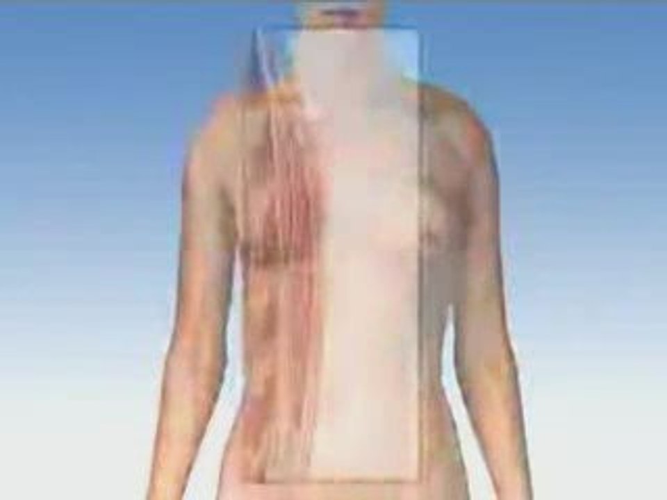 Breast Reconstruction