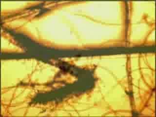 Recherche parasitaire étape 2 "le microscope"