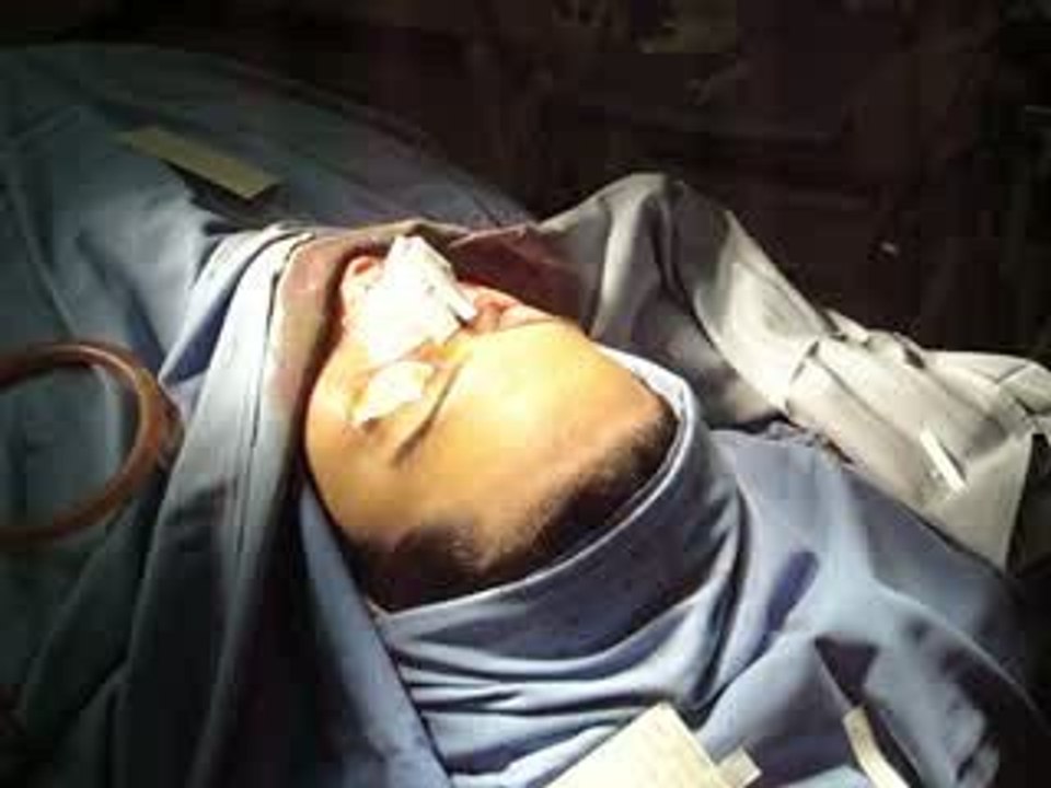جراح تجميل عراقي,عمليات التجميل,تجميل الانف,-قطر-دبي,عراق