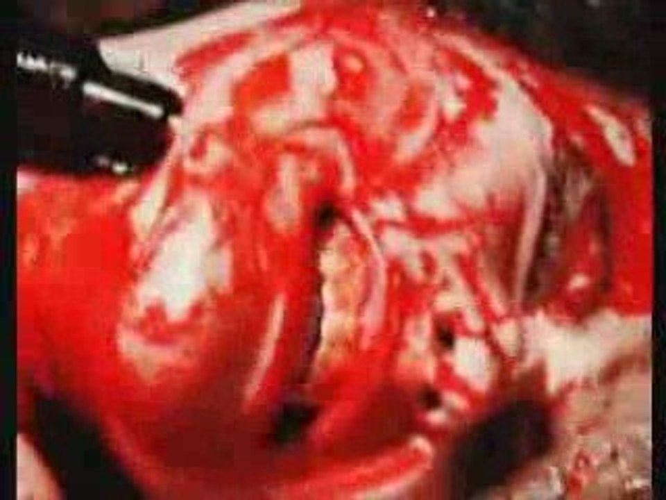 Severe Torture - Decree of Darkness