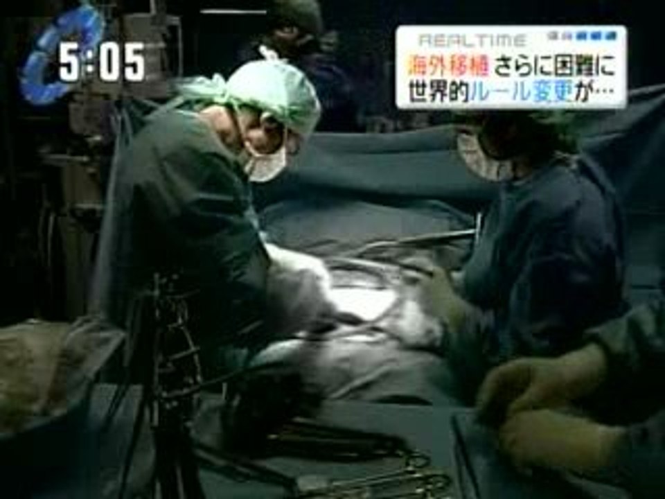Transplante