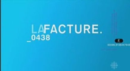 Épilation au laser des risques de brûlures.mpg