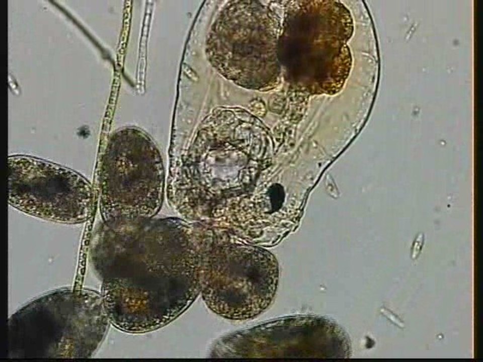 CILIATE DEVOURING ROTIFER