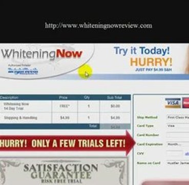 Dental Teeth Whitening- Dental Teeth Whitening Best Products