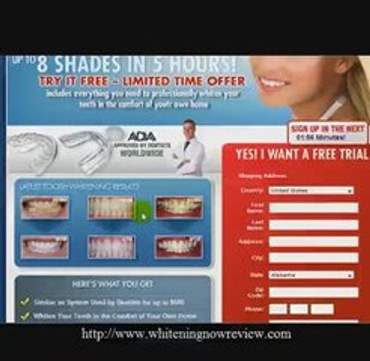 Best Teeth Whitening System- The Secret Best Teeth Whitening
