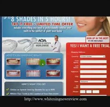 Best Teeth Whitening System- The Secret Best Teeth Whitening