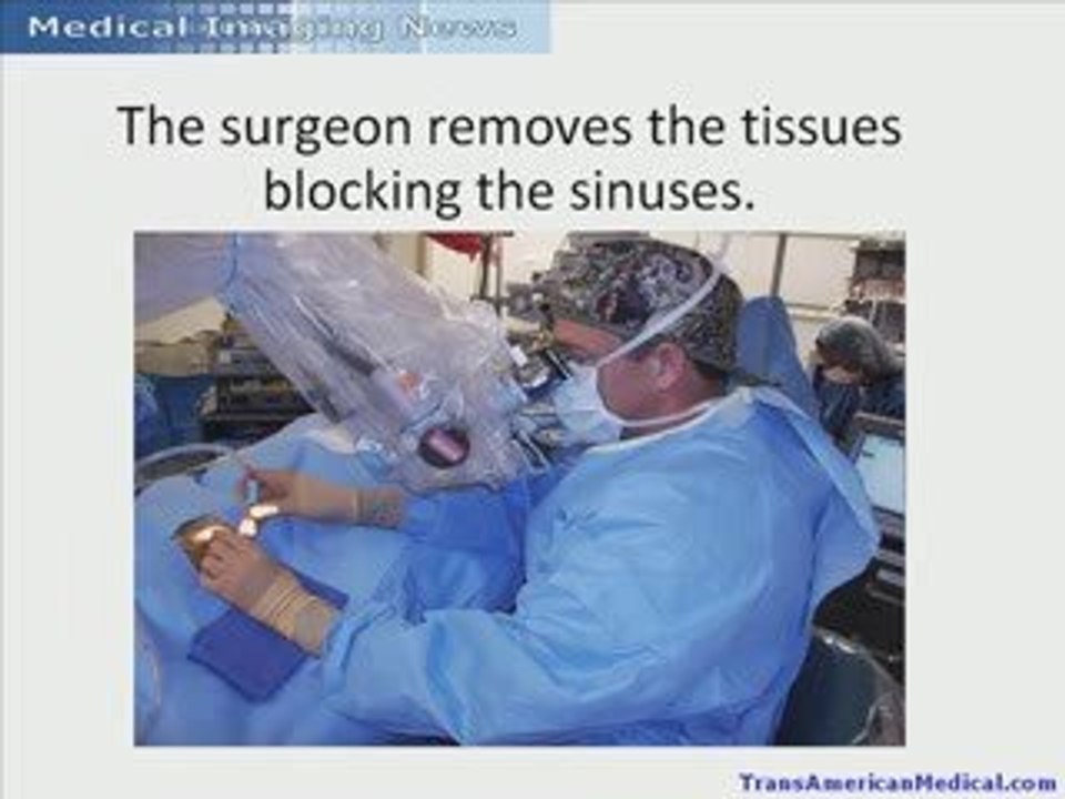 Image Guided Sinus Surgery