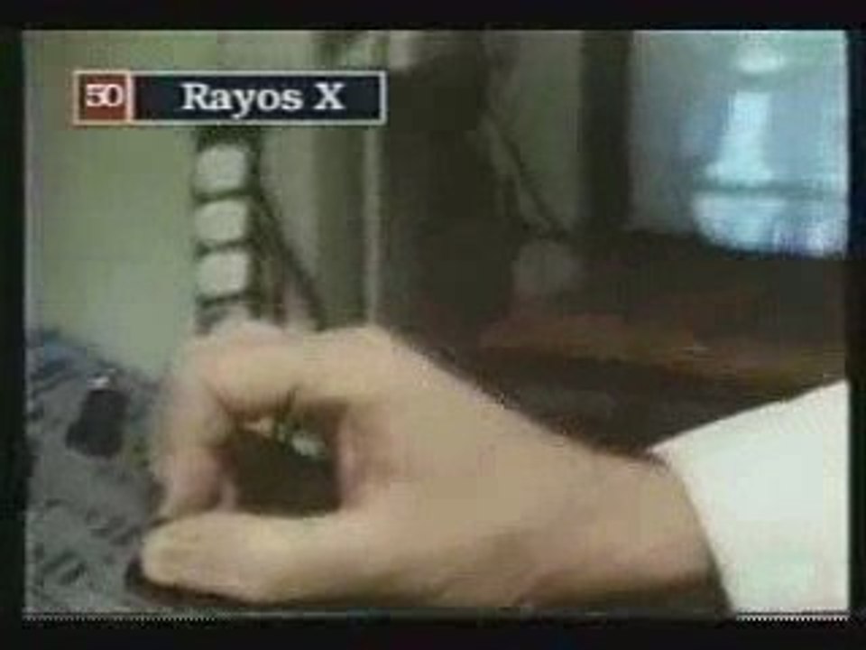 LOS RAYOS X