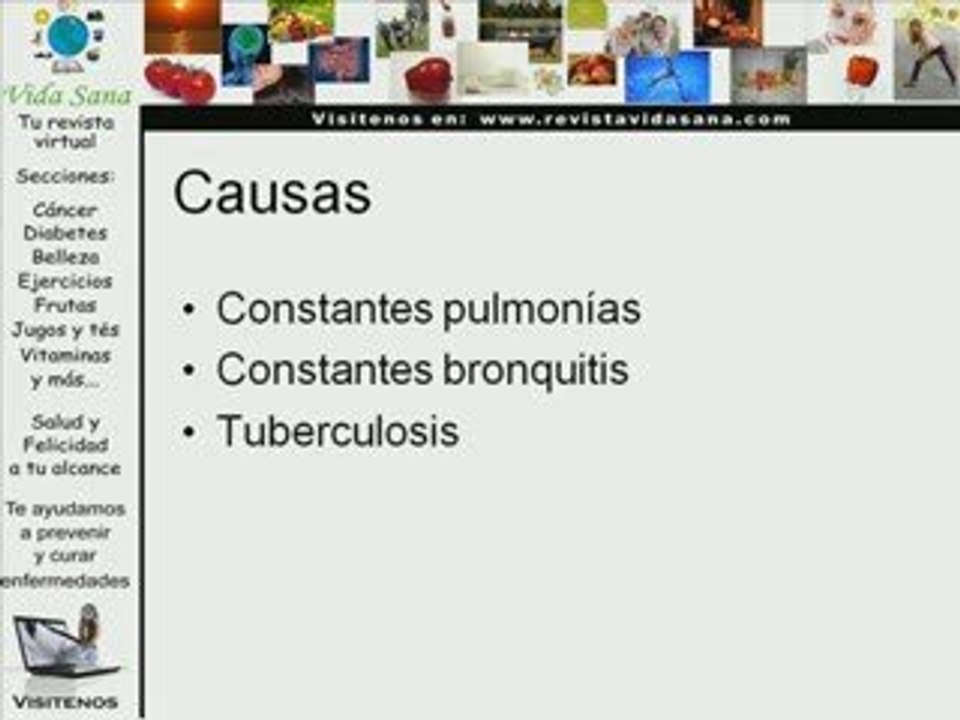 cáncer de pulmón