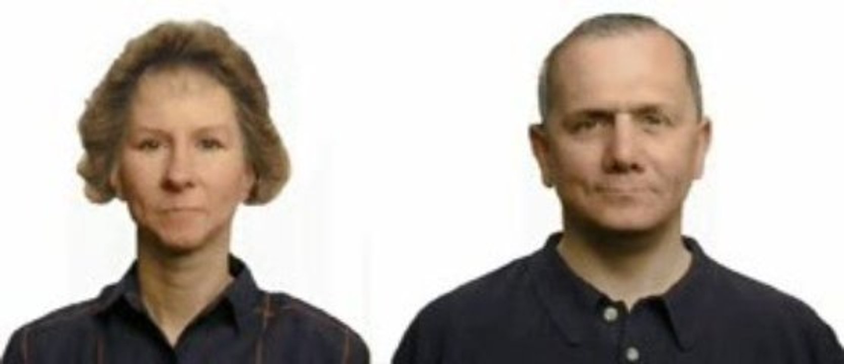 Long Island Periodontist facial changes with toth loss