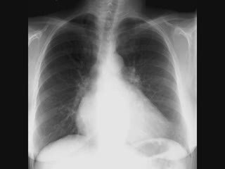 BLB - I am where it takes me