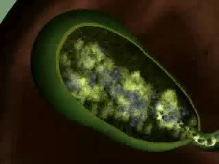 Diet For Gallstones - How Nutrition Can Help You Pass Your G