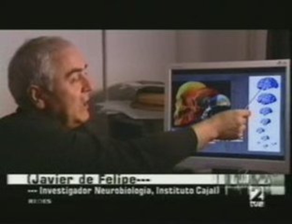 Cerebro y arte