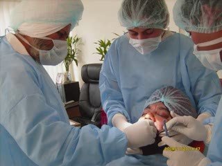 Dentist In jalandhar For Nobel Guide Dental implants