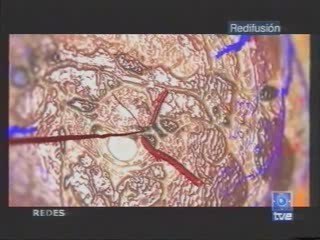 Cancer: Farmacos angiostaticos