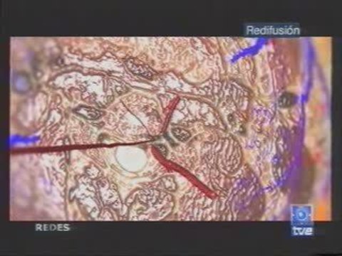 Cancer: Farmacos angiostaticos