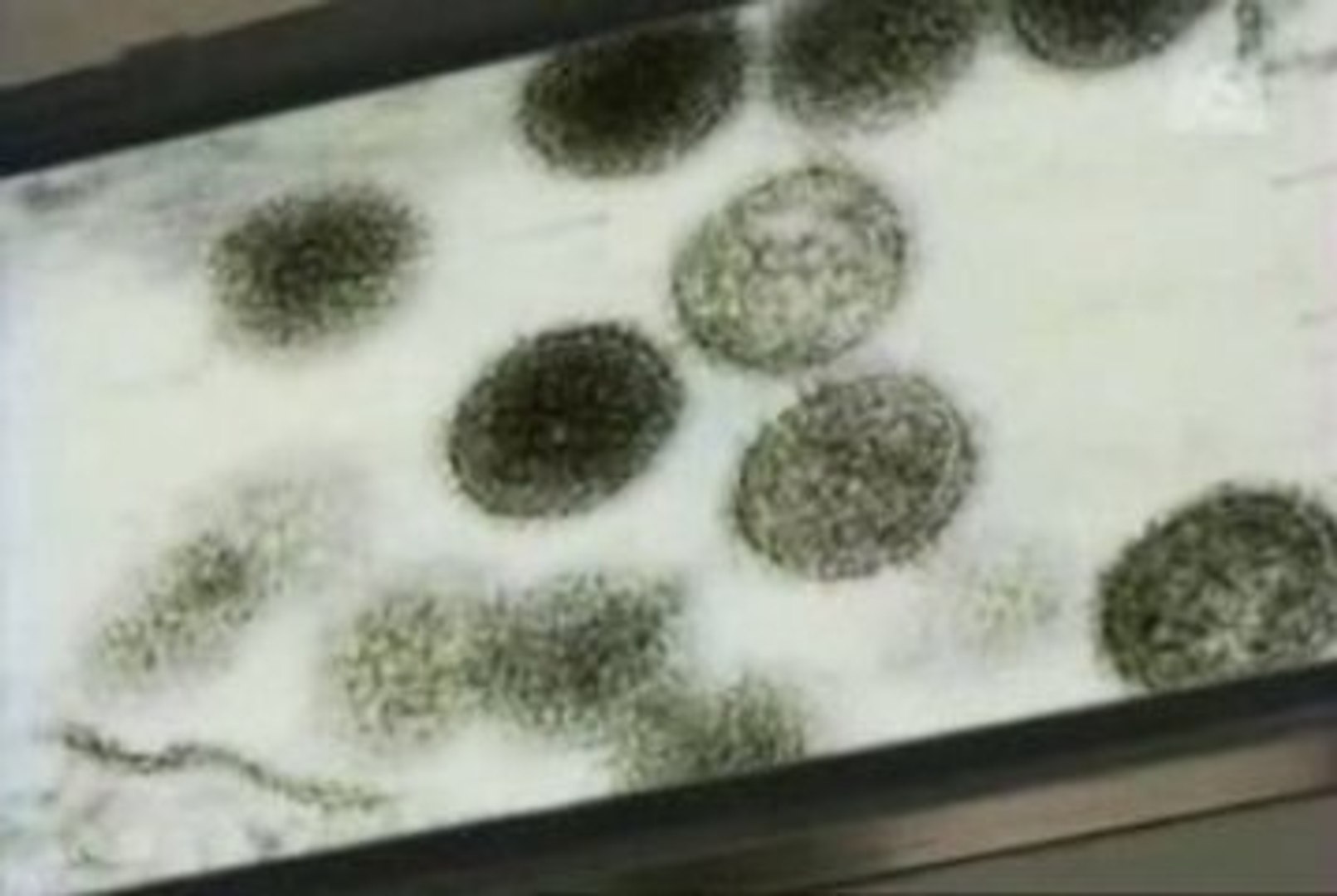 Grippe pandémie BBC News