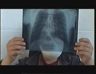 Le Foya EESSCF Anderlues