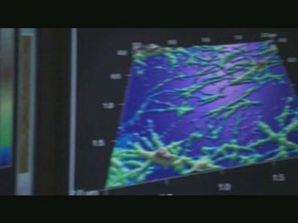 The Alzheimer's Project, Official Trailer