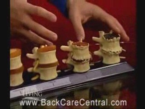 Spinal decompression san diego treatment