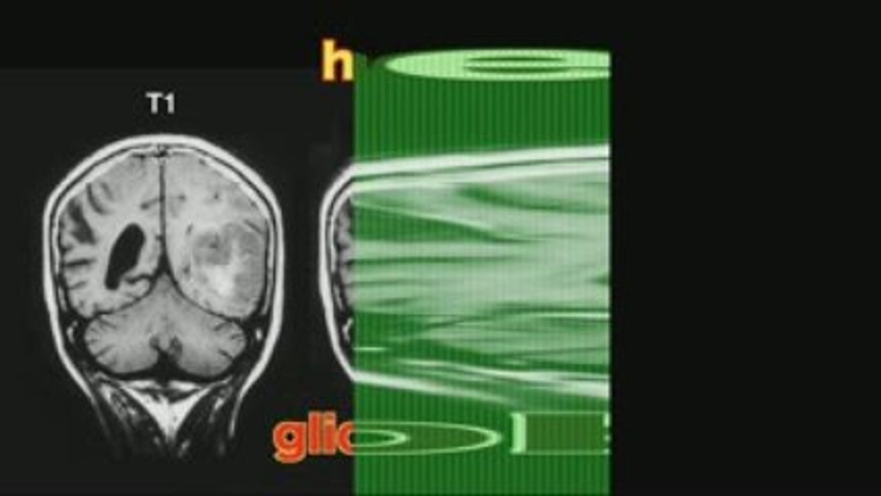Neuroradiology