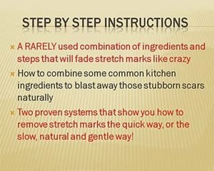 How To Treat Stretch Marks & Cure Strecth Marks