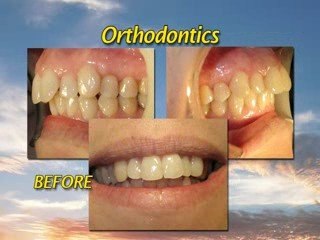 Castro Valley Cosmetic Dentist