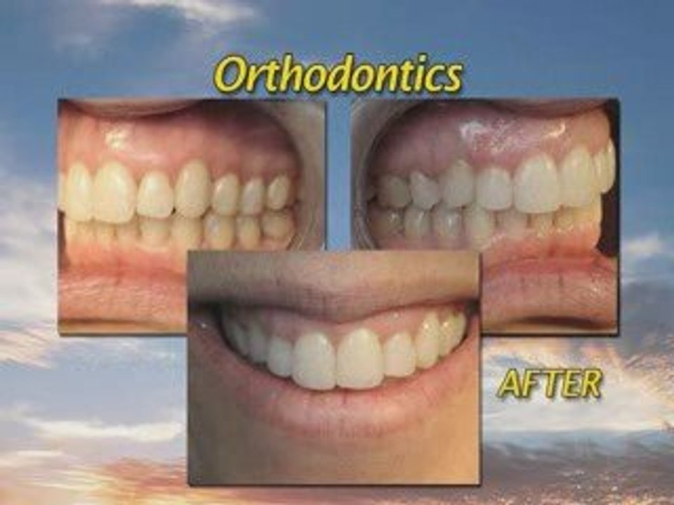 San Leandro Dentistry