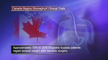 New Non-invasive Weight Loss Treatment Tested