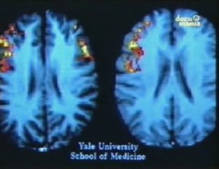 Lenguaje: Diferencias de genero (RMf)