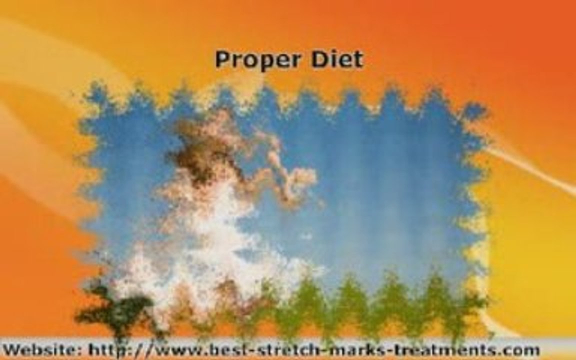 Stretch Marks Creams That Remove Unsightly Stretch Marks