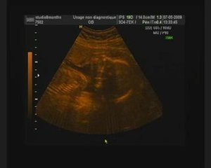 Echo 3D Luna 07 mai 2009 (01)