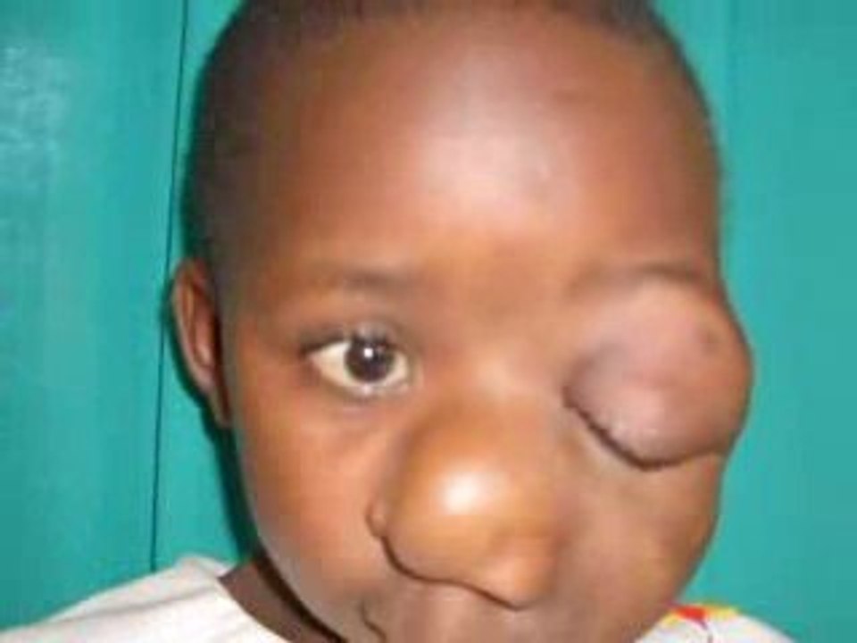 World Craniofacial Foundation