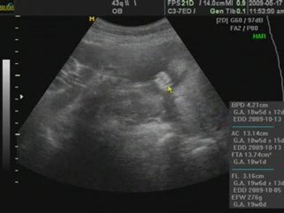 richjoy baby-19 weeks old