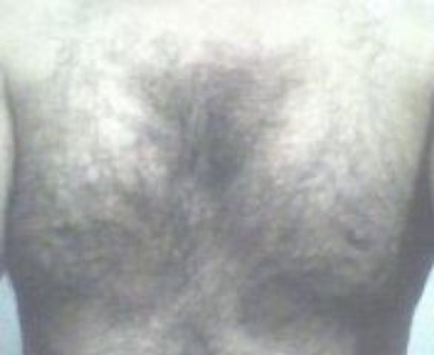 hairy chest