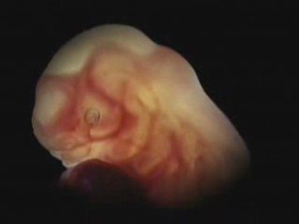 The Wonders of Hashem's Creation & The Miracle of Life