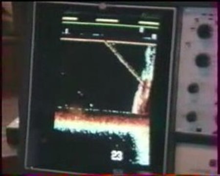 Chalutier Boulonnais le Dogger-bank Novembre 1988-Suite..